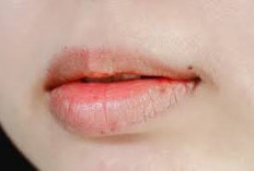 Bibirmu Kering, Ini 6 Cara Pencegahannya