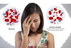 Tak Hanya Bayam, Ini Makanan dan Sayuran Yang Harus Dikonsumsi Penderita Anemia