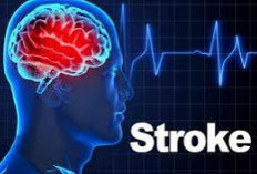 Manfaat Puasa Ternyata Bisa Menurunkan Risiko Stroke, Begini Kata Ahlinya