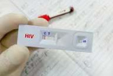 Kerahasiaan Terjamin, Warga Bengkulu Didorong Berani Periksa HIV Sejak Dini